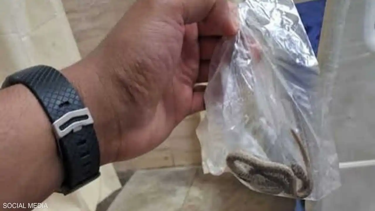 مصر تبحث في ظاهرة لدغات الأفاعي بعد واقعة غريبة لمصاب
